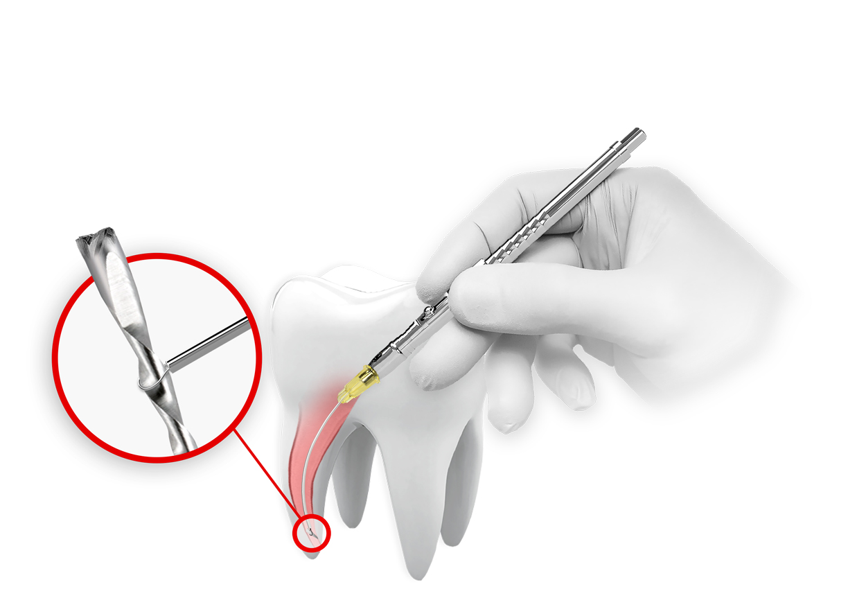 BTR Pen tool held in hand
